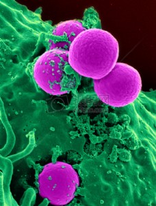 电子显微镜下的细胞