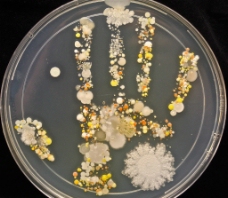 手掌细菌图片